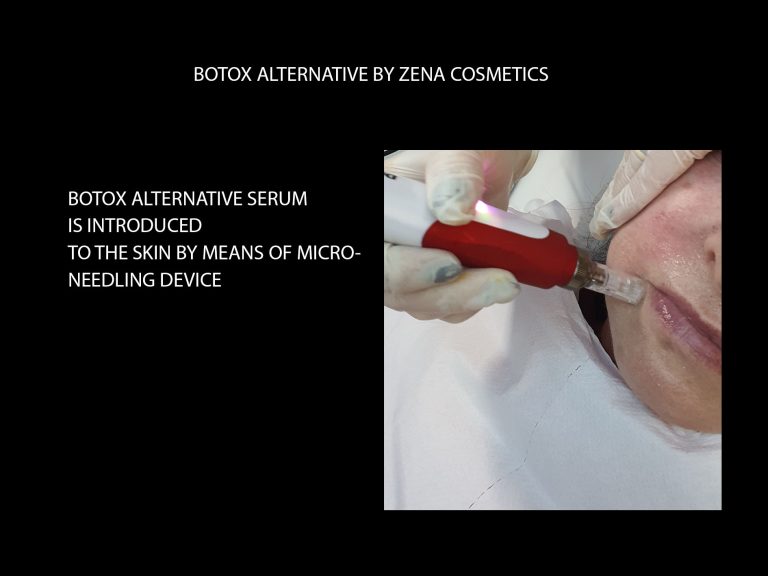 BOTOX ALTERNATIVE MICRO NEEDLING